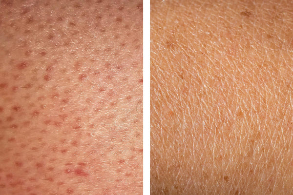 Éclat Noir 8 Ounce Brightening Body Scrub Polish Smooth Glow Refines Texture & Reveals Radiant Skin Care for All Types