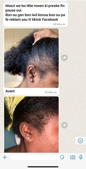 Grandma hair grow