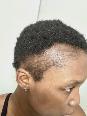 Grandma hair grow
